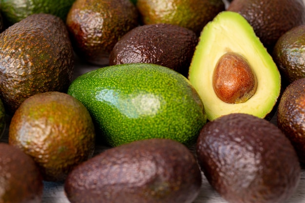 Avocado properties for kidney stones